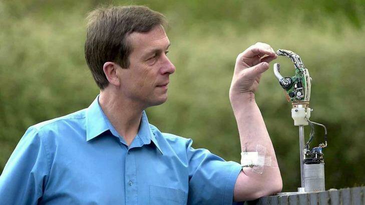 Professor Kevin Warwick and his Cybernetic Arm. Photo: REX